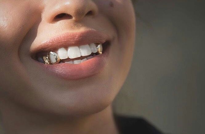 دندان طلا چیست